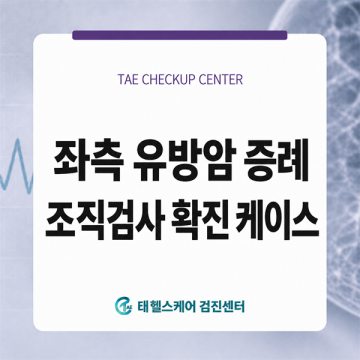 국가 암검진 유방촬영 후, 당일 초음파·조직검사로 확인한 좌측 유방암 썸네일