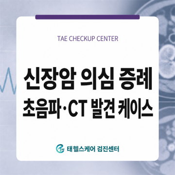 검단 건강검진 복부초음파에서 발견된 우측 신장 종괴, CT로 신장암 의심 썸네일